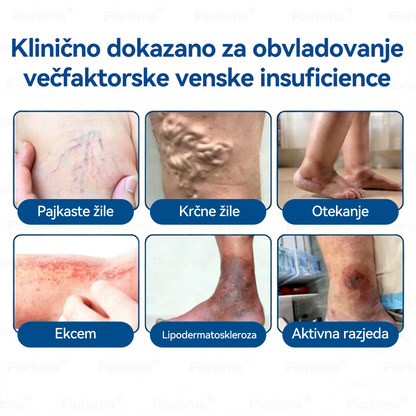 🛡️ 𝐅𝐋𝐎𝐑𝐈𝐒𝐌𝐀®👩🏻‍⚕️🎁 𝐃𝐈𝐎𝐒𝐌𝐈𝐍 𝐈𝐍 𝐇𝐄𝐒𝐏𝐄𝐑𝐈𝐃𝐈𝐍 𝐌𝐢𝐤𝐫𝐨𝐢𝐠𝐞𝐥𝐧𝐢 𝐨𝐛𝐥𝐢ž 𝐬 𝐤𝐥𝐢𝐧𝐢č𝐧𝐨 𝐩𝐫𝐞𝐢𝐳𝐤𝐮š𝐞𝐧𝐨 𝐟𝐨𝐫𝐦𝐮𝐥𝐨 — 𝐍𝐚𝐩𝐫𝐞𝐝𝐧𝐚 𝐳𝐞𝐥𝐢šč𝐧𝐚 𝐦𝐞š𝐚𝐧𝐢𝐜𝐚 𝐳𝐚 𝐨𝐝𝐩𝐫𝐚𝐯𝐥𝐣𝐚𝐧𝐣𝐞 𝐩𝐚𝐣𝐤𝐚𝐬𝐭𝐢𝐡 𝐯𝐞𝐧 𝐢𝐧 𝐥𝐚𝐣š𝐚𝐧𝐣𝐞 𝐭𝐞ž𝐤𝐢𝐡, 𝐮𝐭𝐫𝐮𝐣𝐞𝐧𝐢𝐡 𝐧𝐨𝐠 🔥