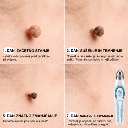 𝐏𝐢𝐜𝐝𝐨® 7-dnevno pisalo za odstranjevanje pigmentnih madežev in brazgotin (neboleče, brez brazgotin – z valjčnim aplikatorjem) 🎇