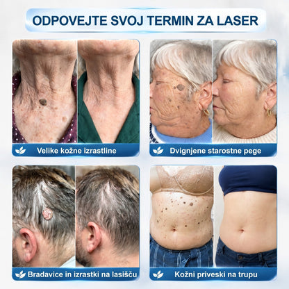 𝐏𝐢𝐜𝐝𝐨® 7-dnevno pisalo za odstranjevanje pigmentnih madežev in brazgotin (neboleče, brez brazgotin – z valjčnim aplikatorjem) 🎇