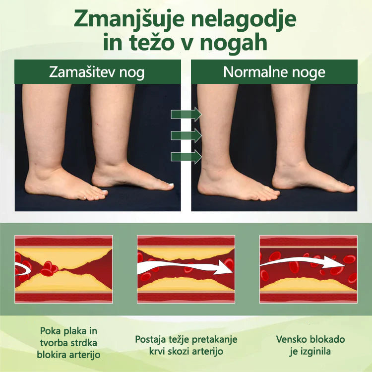 ✨ Poslovite se od otečenih, bolečih nog – CleraNaure® FluidEase Profesionalna krema za izboljšanje prekrvavitve nog prinaša pravo olajšanje! ✨🦵