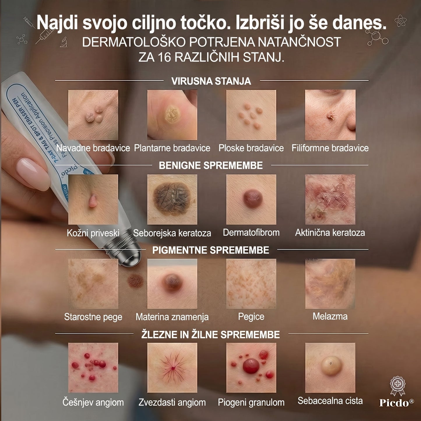 𝐏𝐢𝐜𝐝𝐨® 7-dnevno pisalo za odstranjevanje pigmentnih madežev in brazgotin (neboleče, brez brazgotin – z valjčnim aplikatorjem) 🎇