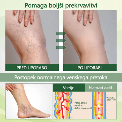 ✨ Poslovite se od otečenih, bolečih nog – CleraNaure® FluidEase Profesionalna krema za izboljšanje prekrvavitve nog prinaša pravo olajšanje! ✨🦵