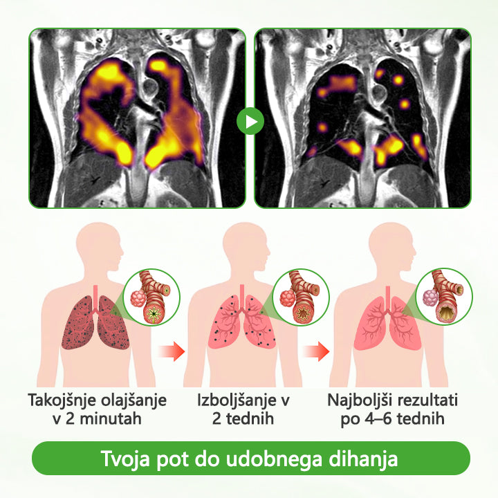💎CleraNaure® HerbaAir Mullein Prečiščevalec Pljuč