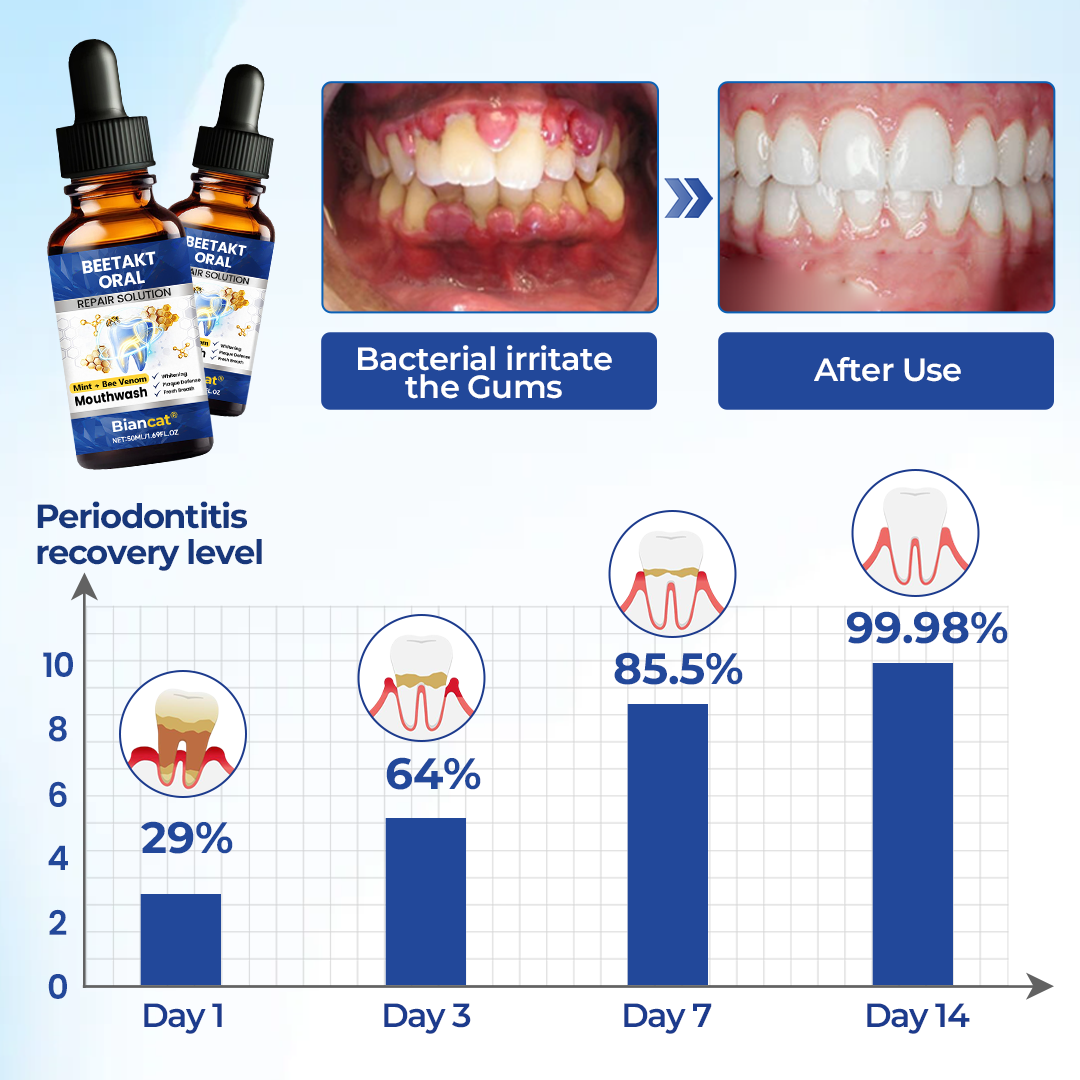 Biancat® BeeTakt Premium Raztopina za Nego Dlesni 🦷 – Napredna Formula s Čebeljim Strupom, Q10, Hialuronsko Kislino in Naravnimi Rastlinskimi Izvlečki za Zdrave Dlesni in Sijoč Nasmeh ✨