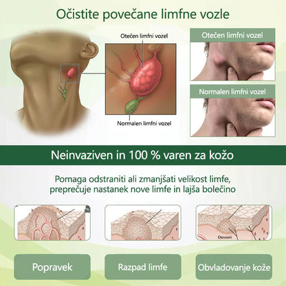 ✨ Poslovite se od otečenih, bolečih nog – CleraNaure® FluidEase Profesionalna krema za izboljšanje prekrvavitve nog prinaša pravo olajšanje! ✨🦵